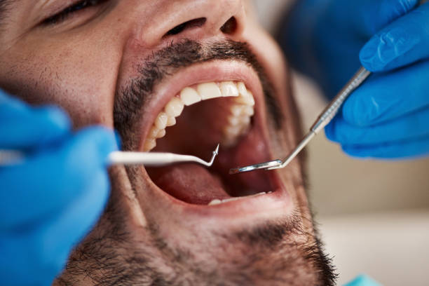 Best Weekend Emergency Dentist in Cedar Heights, MD
