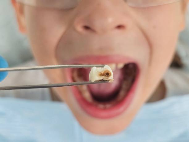 Best Emergency Dental Services for Seniors in Cedar Heights, MD
